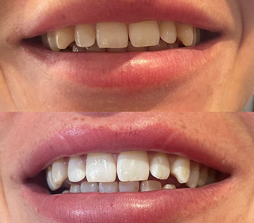 before-after2