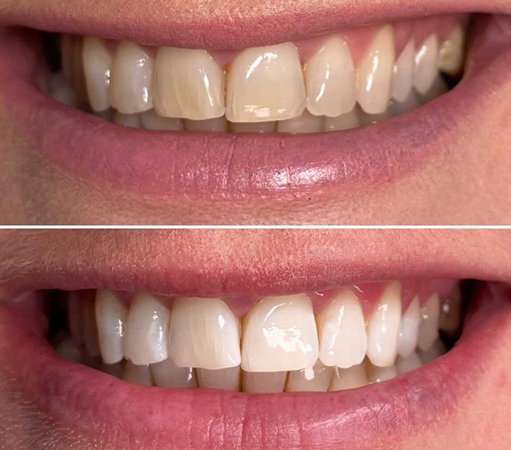 before-after3